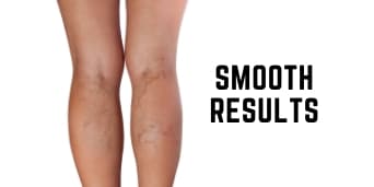 7 Veins Access Wellness Healthcare Modesto CA